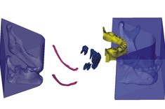 Zagadnienia medyczne w Katedrze Konstrukcji Maszyn
